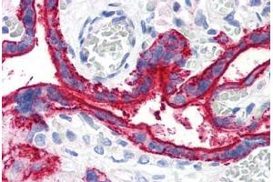 Human Placenta (formalin-fixed, paraffin-embedded) stained with CD59 antibody ABIN290285 at 10 ug/ml followed by biotinylated anti-mouse IgG secondary antibody ABIN481714, alkaline phosphatase-streptavidin and chromogen. (CD59 anticorps)