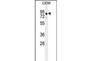 GLB1L2 Antibody (C-term) (ABIN654822 and ABIN2844495) western blot analysis in CEM cell line lysates (35 μg/lane). (GLB1L2 anticorps  (C-Term))