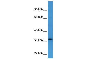 Western Blot showing DOK4 antibody used at a concentration of 1-2 ug/ml to detect its target protein. (DOK4 anticorps  (C-Term))