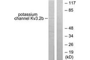 Western blot analysis of extracts from HepG2 cells, using Potassium Channel Kv3. (Kv3.2b Potassium Channel anticorps  (AA 589-638))
