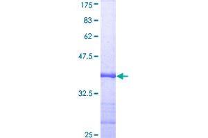 Receptor (TNFRSF)-Interacting serine-threonine Kinase 1 (RIPK1) (AA 562-671) protein (GST tag)