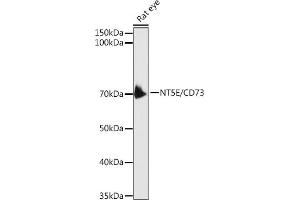 Western blot analysis of extracts of Rat eye, using CD73/NT5E antibody (ABIN3022733, ABIN3022734, ABIN3022735, ABIN1513283 and ABIN6219201) at 1:1000 dilution.