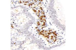 Immunohistochemistry analysis of paraffin-embedded mouse kidney using,STC (ABIN7075723) at dilution of 1: 800