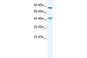 WB Suggested Anti-CBX8 Antibody Titration:  0. (CBX8 anticorps  (Middle Region))