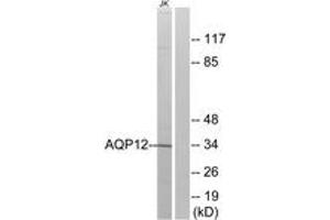Western blot analysis of extracts from Jurkat cells, using AQP12 Antibody. (Aquaporin 12A anticorps  (AA 231-280))