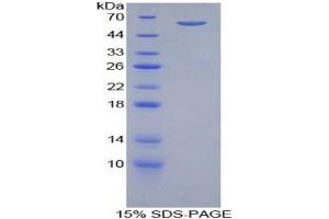 SDS-PAGE analysis of Human ADRbK1 Protein.