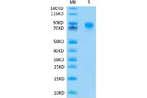 Human TNFR2 on Tris-Bis PAGE under reduced conditions.