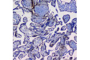IHC analysis of Integrin alpha 5 using anti-Integrin alpha 5 antibody . (ITGA5 anticorps  (AA 42-263))