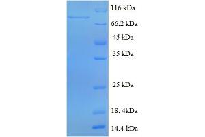 SDS-PAGE (SDS) image for DENN/MADD Domain Containing 1A (DENND1A) (AA 1-559), (full length) protein (His-SUMO Tag) (ABIN5711547) (DENND1A Protein (AA 1-559, full length) (His-SUMO Tag))