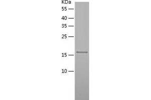 Western Blotting (WB) image for Dual Specificity Phosphatase 18 (DUSP18) (AA 1-188) protein (His-IF2DI Tag) (ABIN7122710)