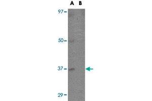Western blot analysis of EBI3 in K-562 cell lysate with EBI3 polyclonal antibody  at 1 ug/mL in (A) the absence and (B) the presence of blocking peptide. (EBI3 anticorps  (C-Term))