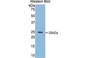 Western blot analysis of the recombinant protein. (RALBP1 anticorps  (AA 192-380))