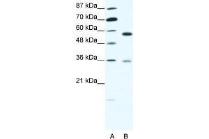 WB Suggested Anti-GDI1 Antibody Titration:  1. (GDI1 anticorps  (C-Term))