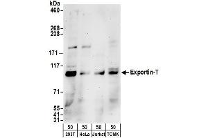 Western Blotting (WB) image for anti-Exportin, tRNA (Nuclear Export Receptor For TRNAs) (XPOT) (AA 825-875) antibody (ABIN7452934)