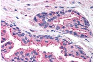 Human Prostate (formalin-fixed, paraffin-embedded) stained with RAB14 antibody ABIN214804 at 5 ug/ml followed by biotinylated goat anti-rabbit IgG secondary antibody ABIN481713, alkaline phosphatase-streptavidin and chromogen.