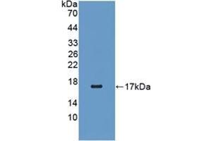 Western blot analysis of recombinant Human RBP5. (Retinol Binding Protein 5 anticorps  (AA 2-135))