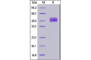 Human CD64, His Tag on  under reducing (R) condition.