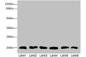 Western blot All lanes: CFL2 antibody at 3. (Cofilin 2 anticorps  (AA 1-166))