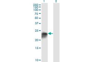Western Blot analysis of UCHL1 expression in transfected 293T cell line by UCHL1 monoclonal antibody (M01), clone 1B8-4D2.