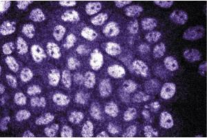 Immunofluorescence staining of A431 cells (Human epithelial carcinoma, ATCC CRL-1555). (DDB1 anticorps  (AA 739-935))