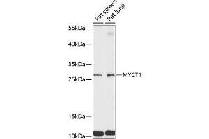 Western blot analysis of extracts of various cell lines, using MYCT1 antibody (ABIN7268717) at 1:3000 dilution. (Myc Target 1 anticorps  (AA 99-235))