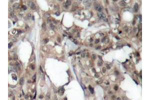 Image no. 3 for anti-V-Akt Murine Thymoma Viral Oncogene Homolog 1 (AKT1) antibody (ABIN265302) (AKT1 anticorps)