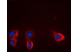 Immunofluorescent analysis of TRK B staining in HL60 cells. (TRKB anticorps  (Center))