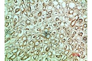 Immunohistochemical analysis of paraffin-embedded human-kidney, antibody was diluted at 1:200 (Fibronectin 1 anticorps  (AA 1268-1341))