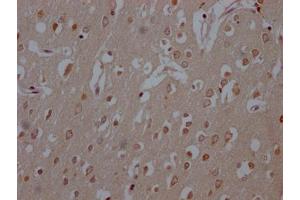 IHC image of ABIN7127433 diluted at 1:100 and staining in paraffin-embedded human brain tissue performed on a Leica BondTM system.