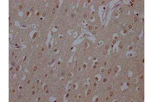 IHC image of ABIN7127433 diluted at 1:100 and staining in paraffin-embedded human brain tissue performed on a Leica BondTM system. (Recombinant COMT anticorps)