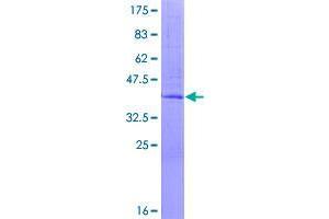 Image no. 1 for ER Degradation Enhancer, Mannosidase alpha-Like 3 (EDEM3) (AA 1-122) protein (GST tag) (ABIN1352316)