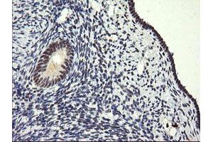 Image no. 3 for anti-SEC14 and Spectrin Domains 1 (SESTD1) antibody (ABIN1501066) (SESTD1 anticorps)
