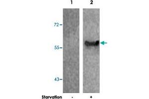 Western blot analysis of extract from 293 cells untreated or treated starvation using G3BP1 (phospho S232) polyclonal antibody . (G3BP1 anticorps  (pSer232))