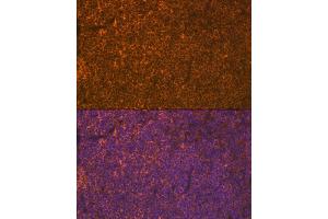 Immunofluorescence analysis of mouse spleen using LSP1 Rabbit mAb (ABIN7268319) at dilution of 1:100 (40x lens).