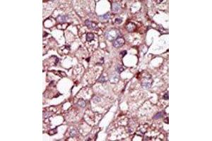 Image no. 1 for anti-Activin A Receptor Type II-Like 1 (ACVRL1) (N-Term) antibody (ABIN360124) (ACVRL1 anticorps  (N-Term))