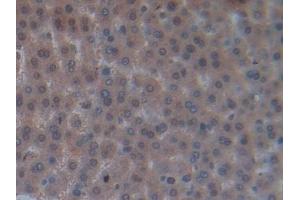 Detection of OCM in Rat Liver Tissue using Polyclonal Antibody to Oncomodulin (OCM)