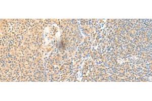 Immunohistochemistry of paraffin-embedded Human tonsil tissue using SSC4D Polyclonal Antibody at dilution of 1:70(x200) (SRCRB4D anticorps)