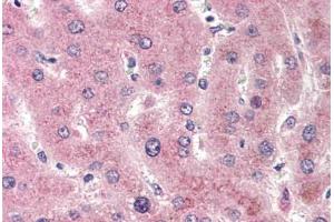 Human Liver (formalin-fixed, paraffin-embedded) stained with CYP2E1 antibody ABIN301632 at 20 ug/ml followed by biotinylated goat anti-rabbit IgG secondary antibody ABIN481713, alkaline phosphatase-streptavidin and chromogen. (CYP2E1 anticorps  (C-Term))