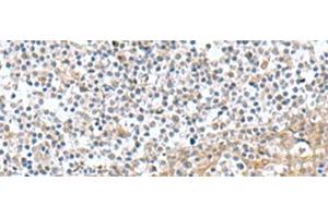 Immunohistochemistry of paraffin-embedded Human tonsil tissue using TNNC2 Polyclonal Antibody at dilution of 1:50(x200)