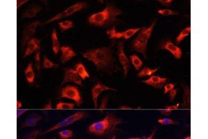 Immunofluorescence analysis of NIH/3T3 cells using FXR1 Polyclonal Antibody at dilution of 1:100.