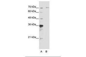Image no. 1 for anti-Interleukin-1 Receptor-Associated Kinase 3 (IRAK3) (AA 441-490) antibody (ABIN6736196) (IRAK3 anticorps  (AA 441-490))