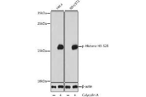 Western blot analysis of extracts of various cell lines, using Phospho-Histone H3-S28 antibody (ABIN7267689) at 1:1000 dilution.
