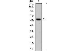 Western blot analysis using CK5 mouse mAb against A431 cell lysate.