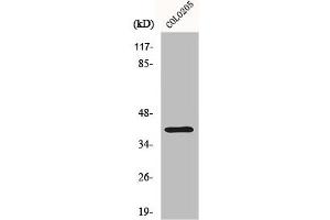 Western Blot analysis of COLO205 cells using Dok-6 Polyclonal Antibody (DOK6 anticorps  (Internal Region))