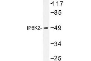 Image no. 1 for anti-Inositol Hexakisphosphate Kinase 2 (IP6K2) antibody (ABIN317720) (IP6K2 anticorps)
