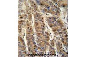 Immunohistochemistry (IHC) image for anti-Complement Component 4 Binding Protein, alpha (C4BPA) antibody (ABIN3002498)