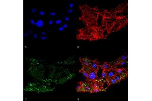 Immunocytochemistry/Immunofluorescence analysis using Rabbit Anti-ATG7 Polyclonal Antibody . (ATG7 anticorps  (N-Term) (APC))
