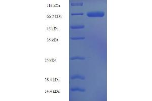SDS-PAGE (SDS) image for PR Domain Containing 16 (PRDM16) (AA 19-471) protein (His-SUMO Tag) (ABIN5710996)