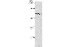 Western Blot analysis of Hela cell using PKM Polyclonal Antibody at dilution of 1:500 (PKM anticorps)