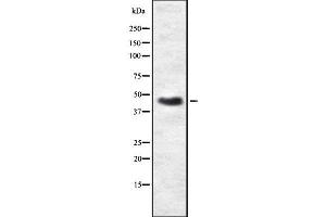 Western blot analysis of PRKAR2B using A549 whole  lysates.